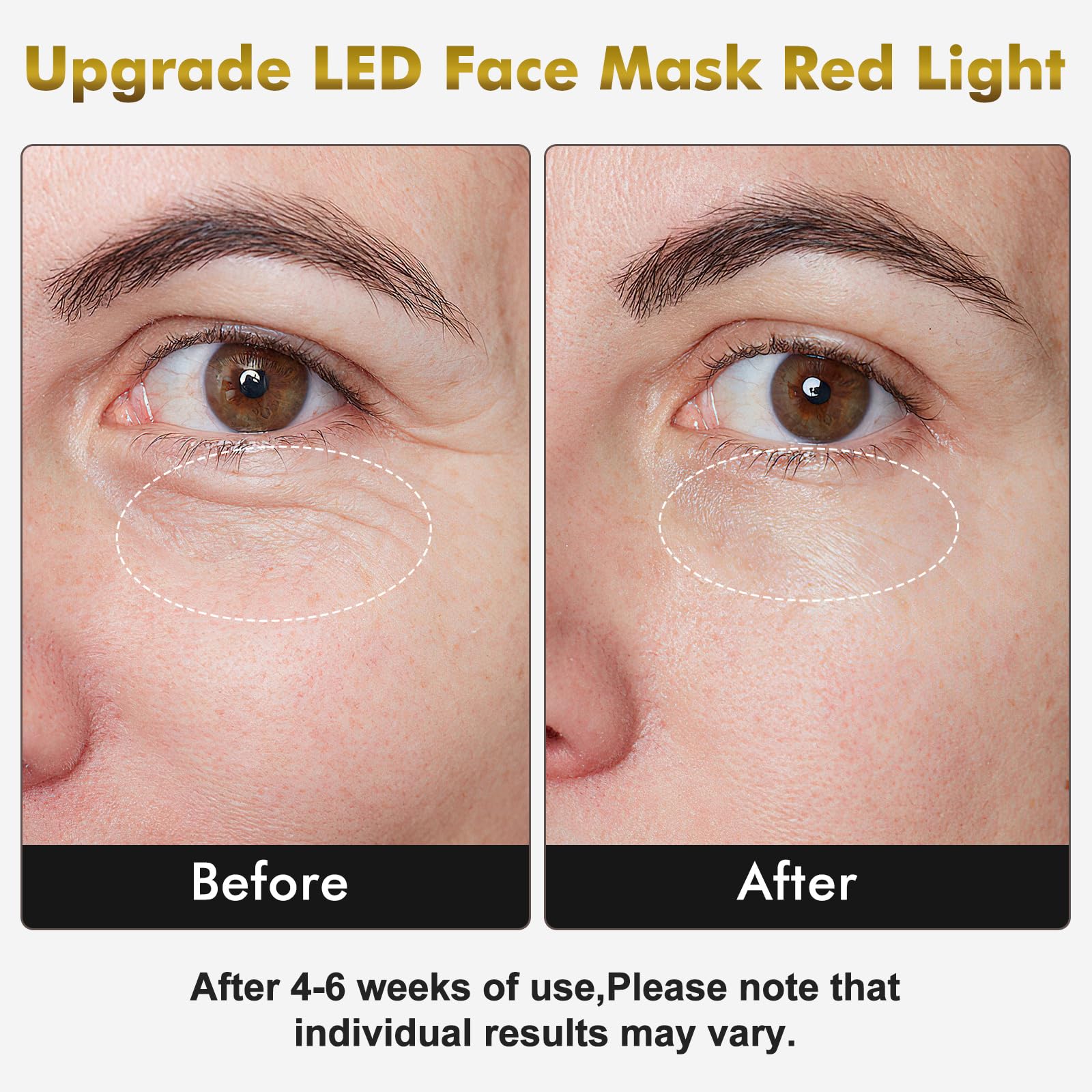 mhpoycd neck mask shows neck coverage for simultaneous light therapy.