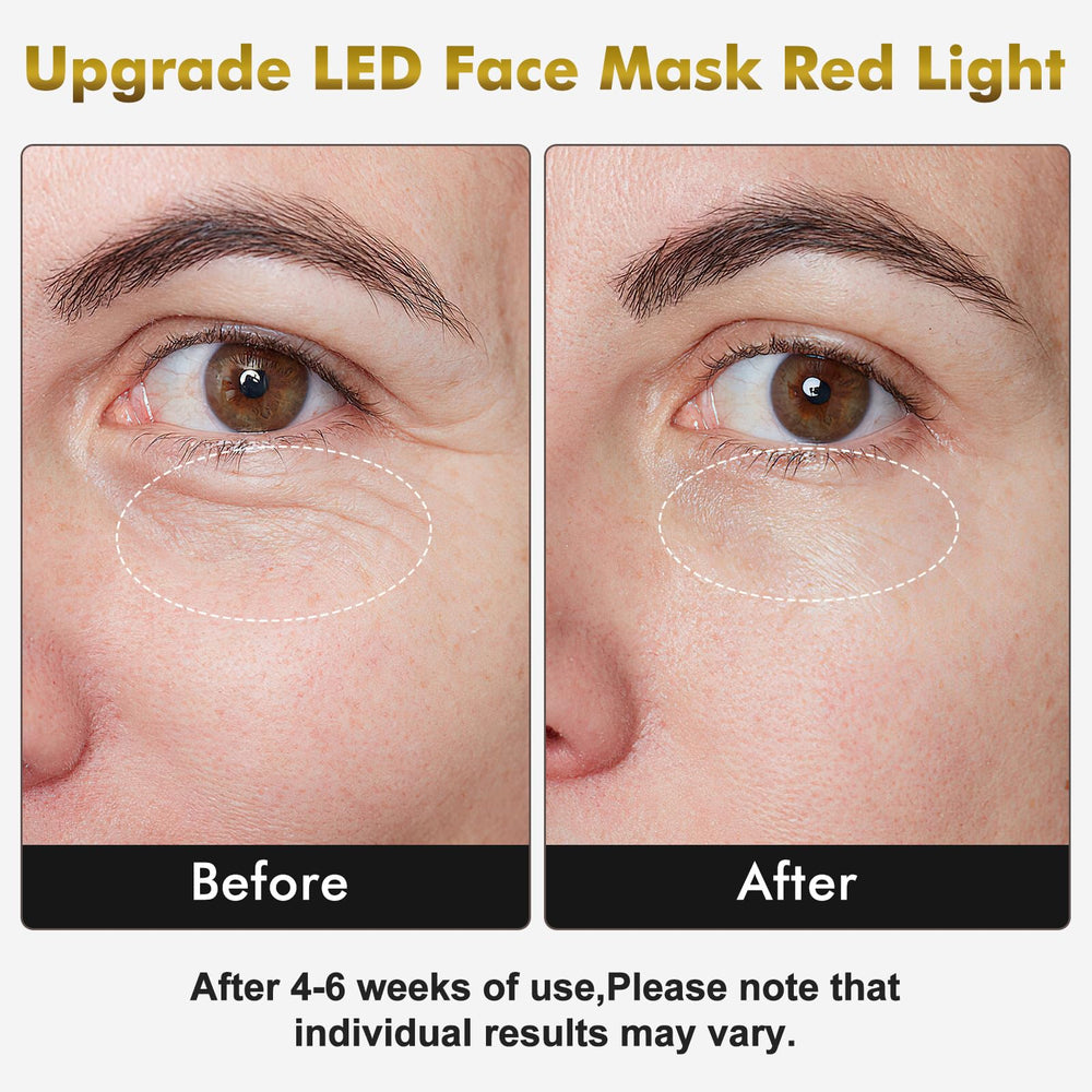 mhpoycd neck mask shows neck coverage for simultaneous light therapy.