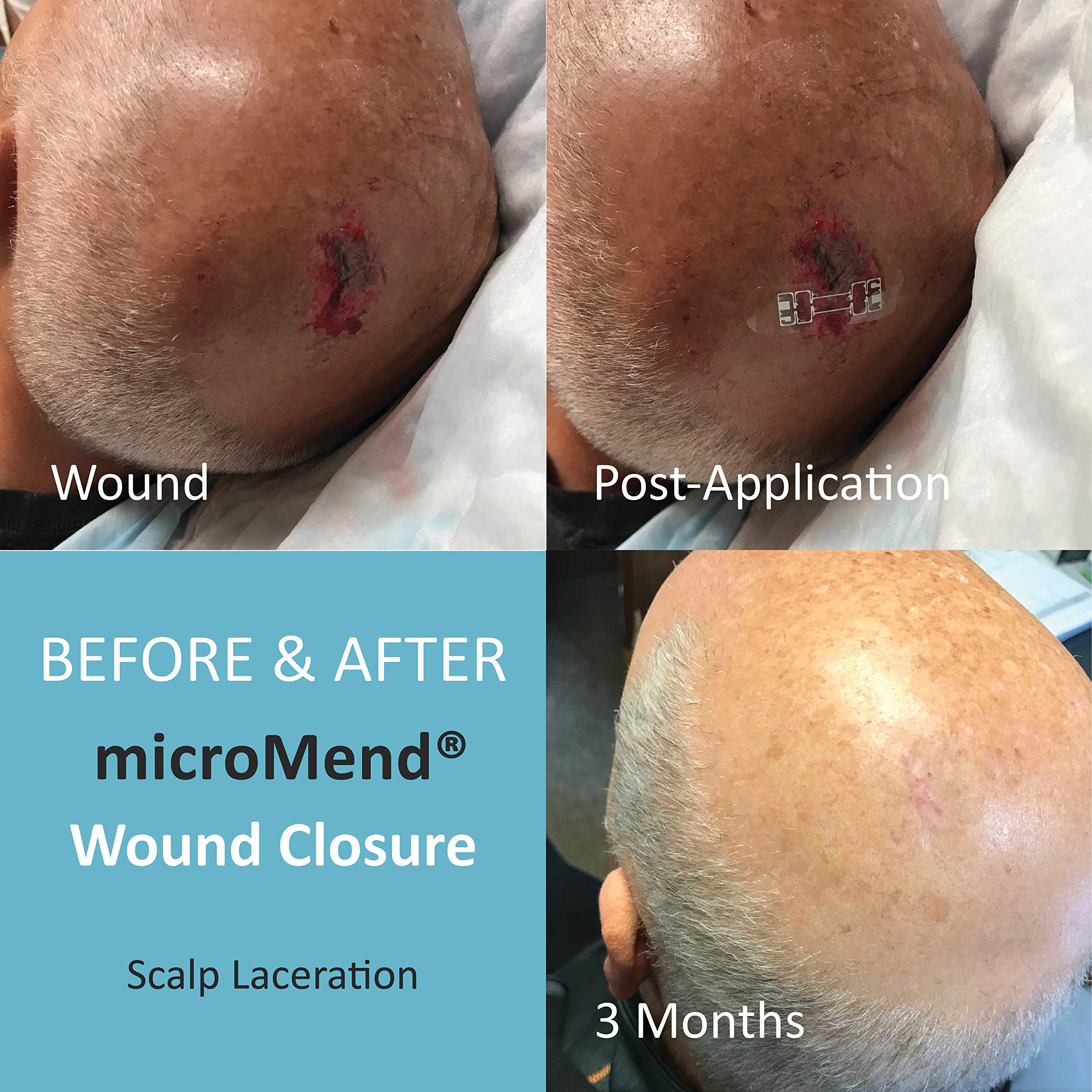 A backpack-ready kit for on-the-go wound care.