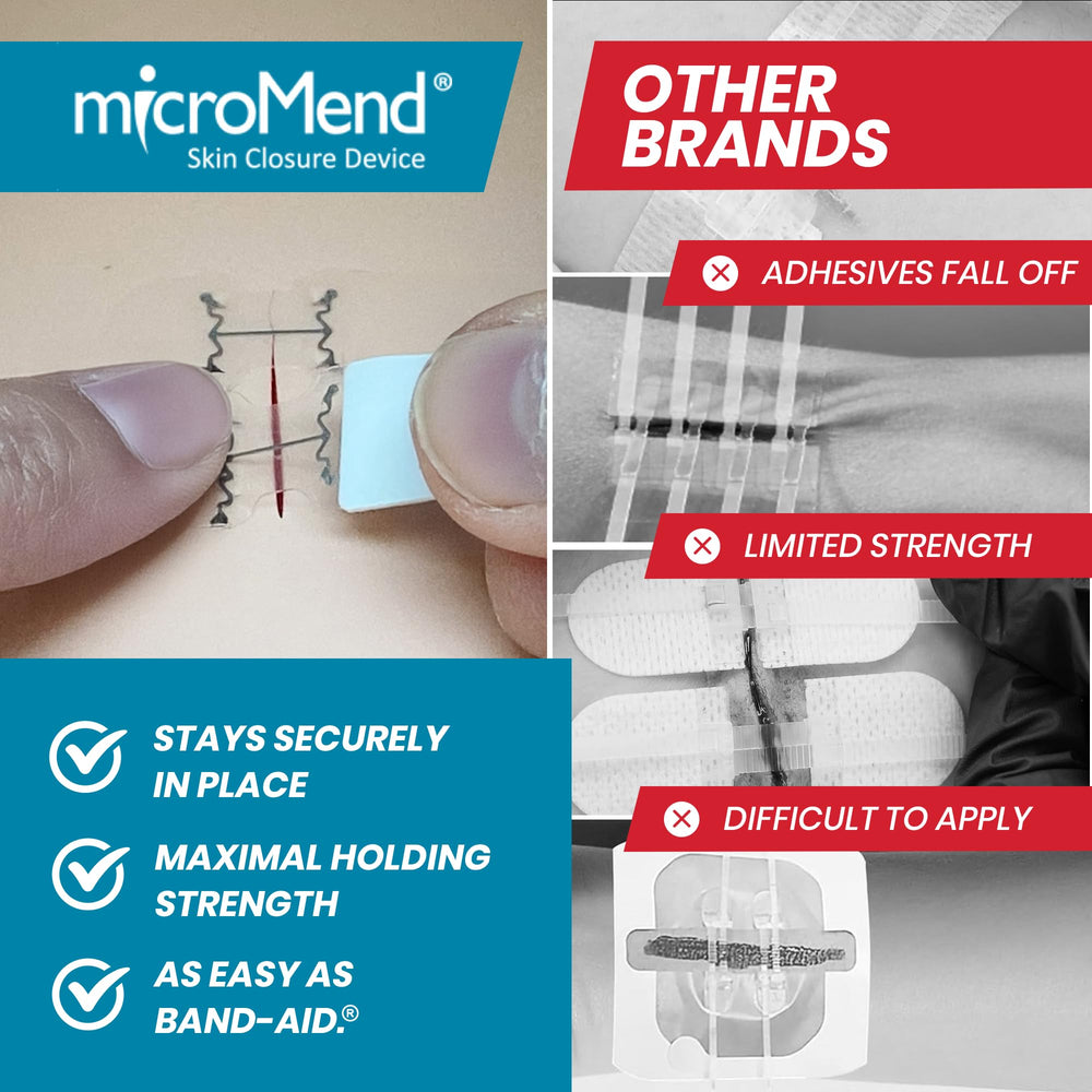 Micromend packaging box image showing a clean, simple-to-use device