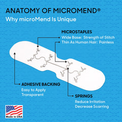 Close-up of microstaples for strong, comfortable wound closure.