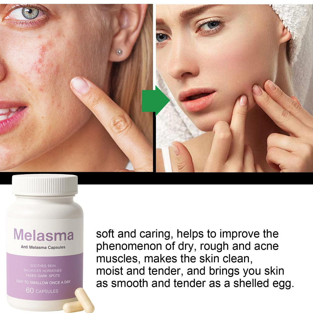 MILIZHIWU capsule closeup showing soft, easy to swallow pills for daily use