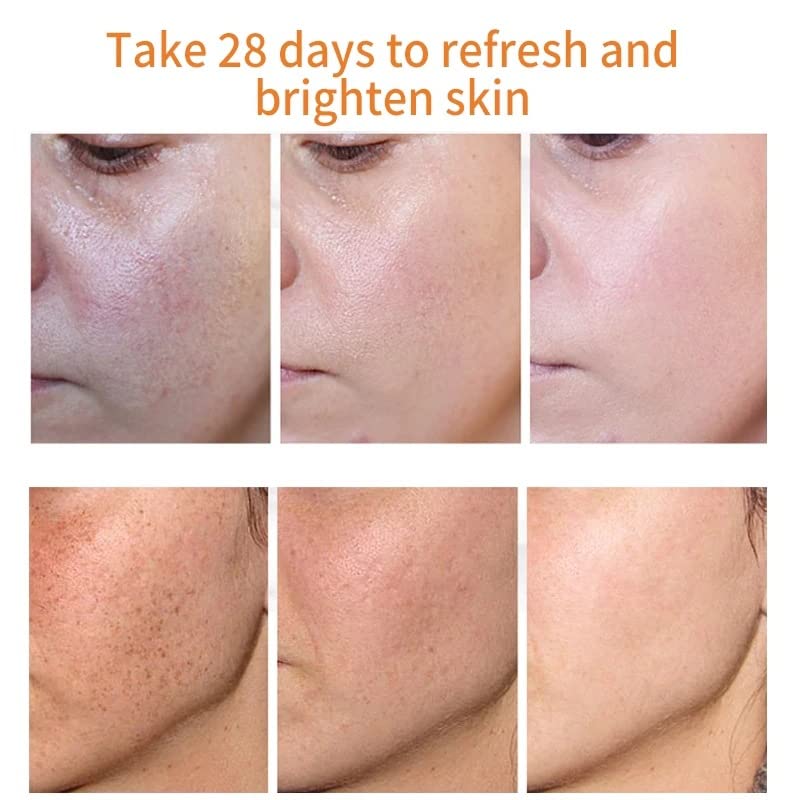 MILIZHIWU vitamin C capsule closeup highlighting antioxidant skin benefits