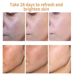 MILIZHIWU vitamin C capsule closeup highlighting antioxidant skin benefits