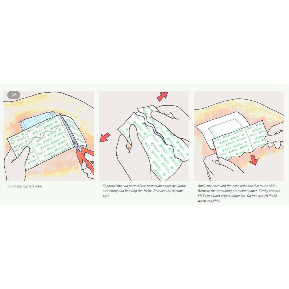 Mefix, cinta fijación-cánulas, cómoda para cuello, codo y rodilla.