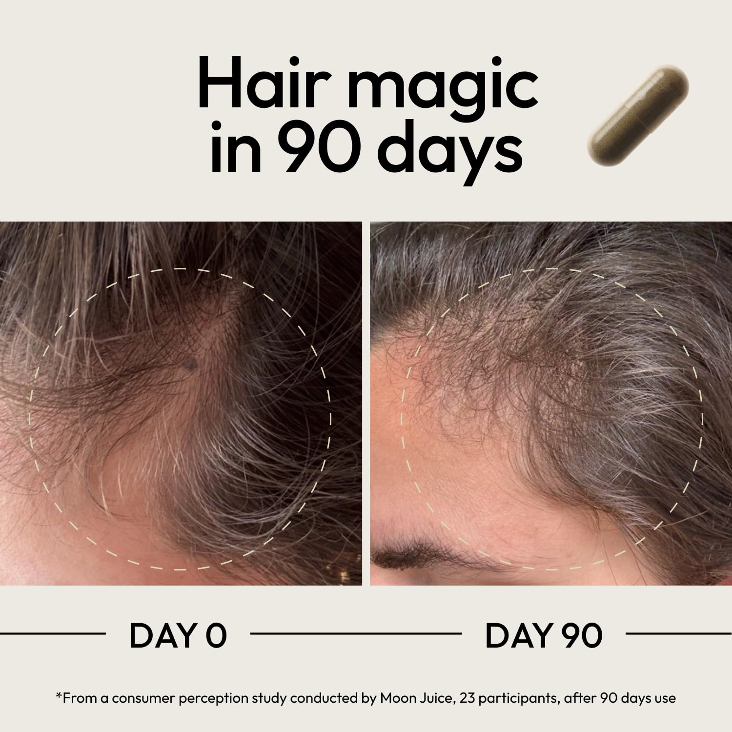 Moon Juice SuperHair featuring saw palmetto and pumpkin seed for follicle support