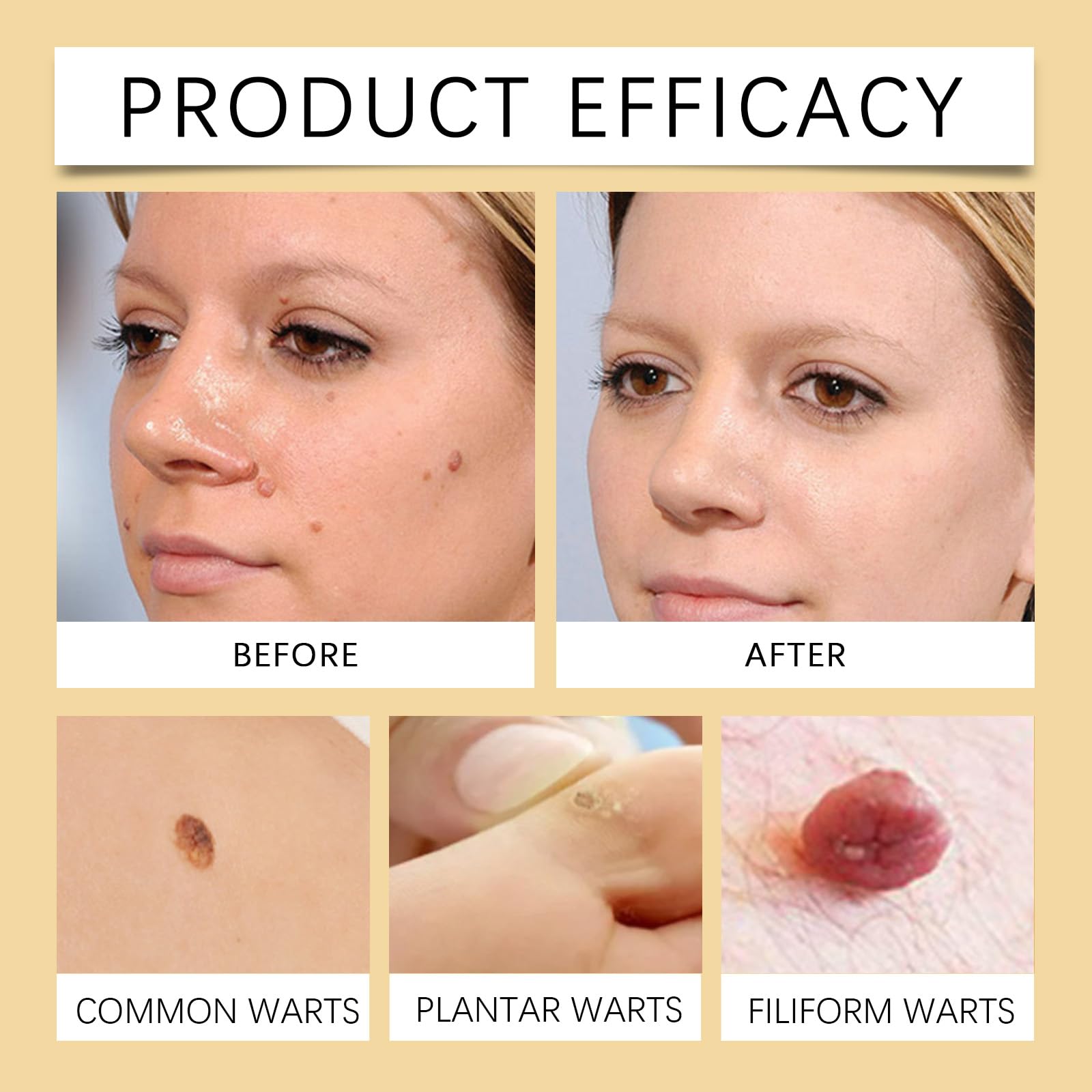 Display of MORKORIA 2-pack wart cream with sleek packaging.