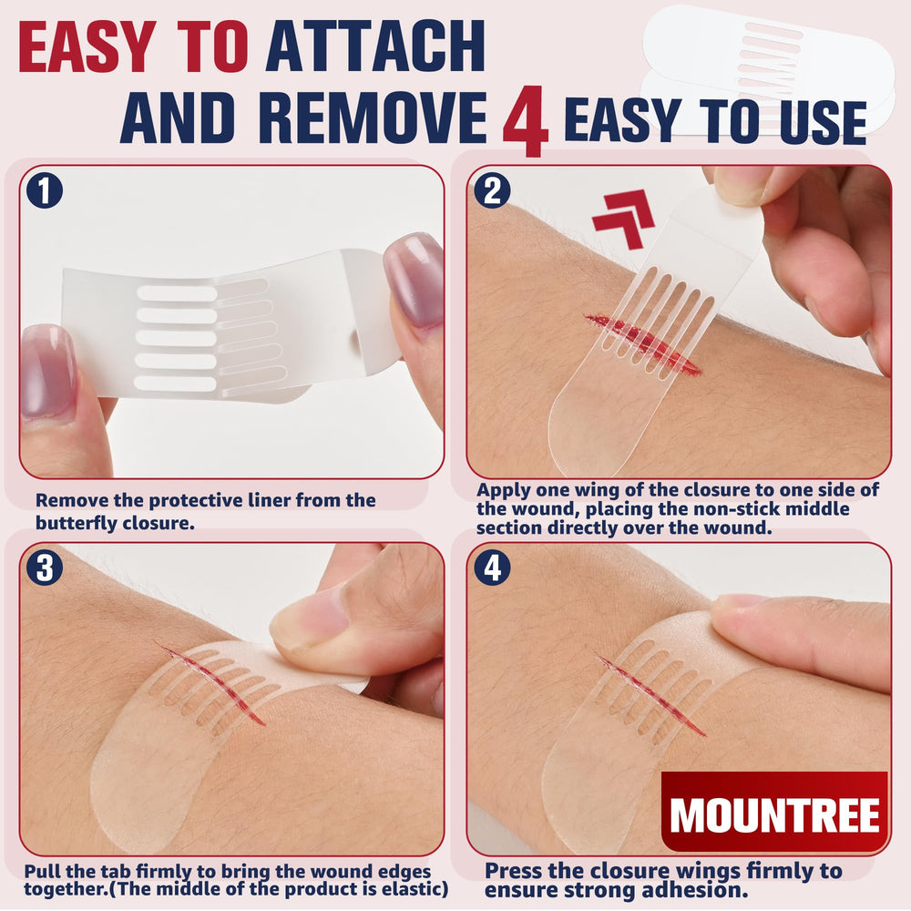 Mountree Edge-Design Closure Strips enable gentle removal when changing dressings.
