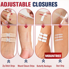 Mountree Wound Closure Strips offer fast adhesion for shallow cuts in busy settings.