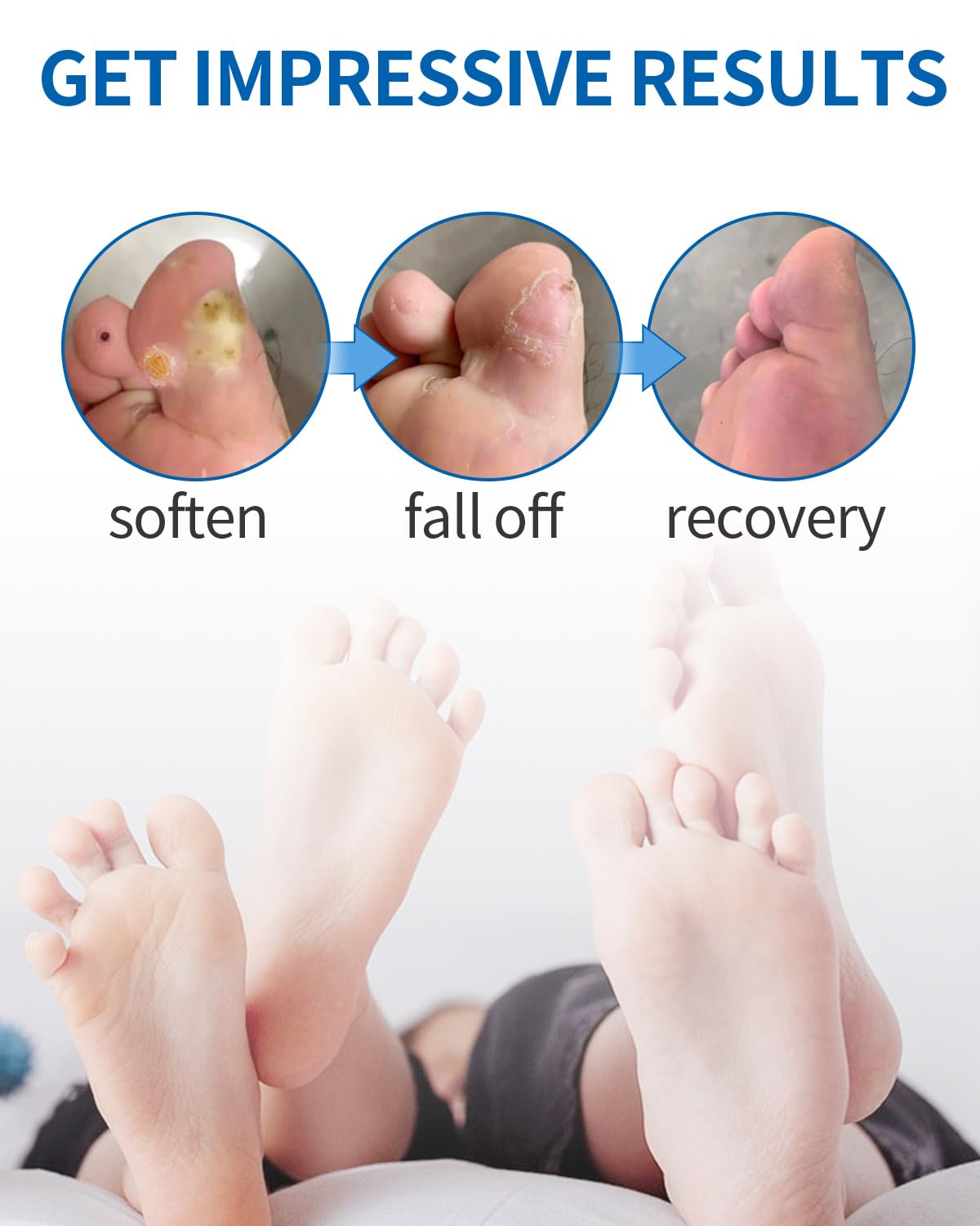 MQ foot care kit displayed for convenient home use