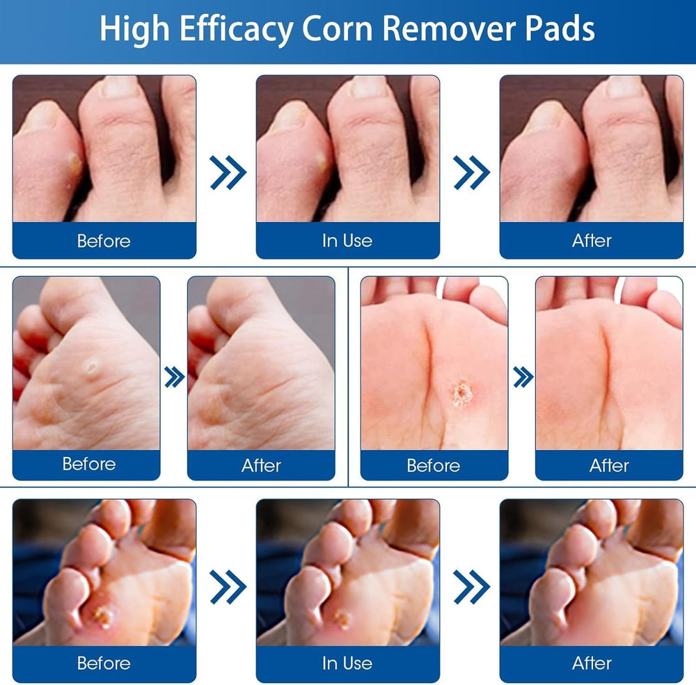 MQUPIN 48-count packaging ready for regular foot care
