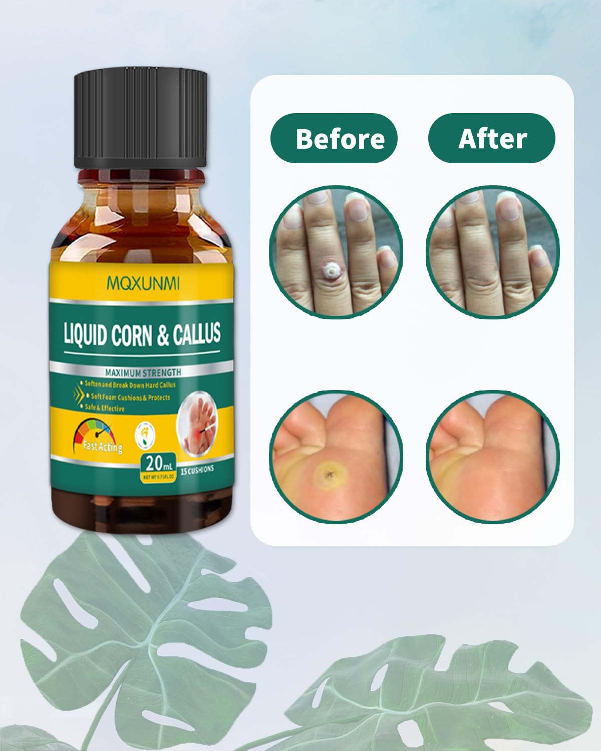MQXUNMI toe close-up shows focused treatment application.