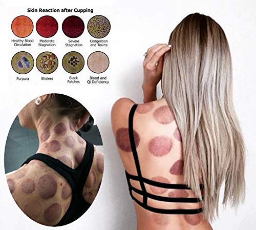Muchoo cellulite-friendly cupping kit for body contour feel.