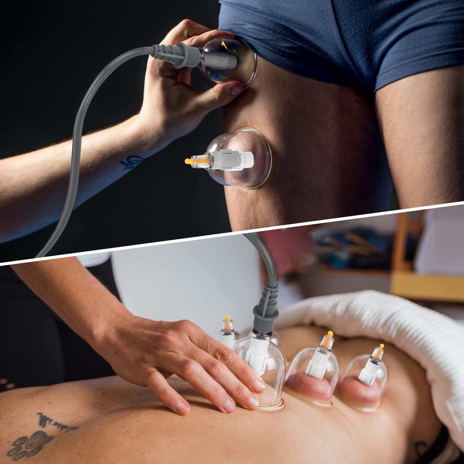 Muchoo cellulite cupping massage kit for contouring and tone support.