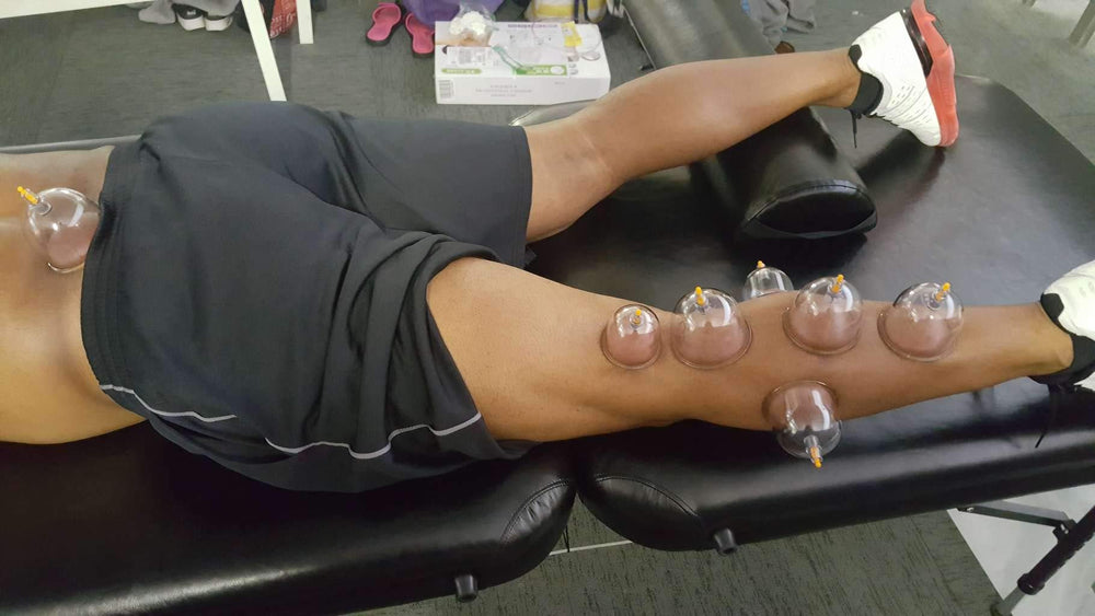 Muchoo hijama cups in multiple diameters for customized coverage and comfort.