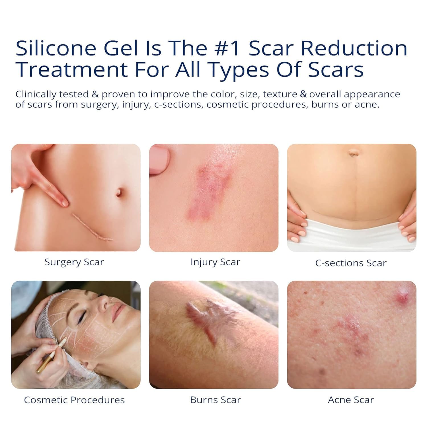 MURASAKI BEAUTY scar gel application on skin for soothing care.