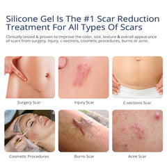 MURASAKI BEAUTY scar gel application on skin for soothing care.