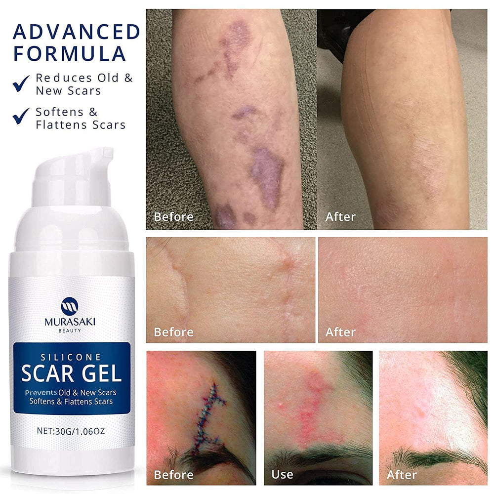 MURASAKI BEAUTY scar gel texture close-up shows non-greasy finish.