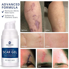 MURASAKI BEAUTY scar gel texture close-up shows non-greasy finish.