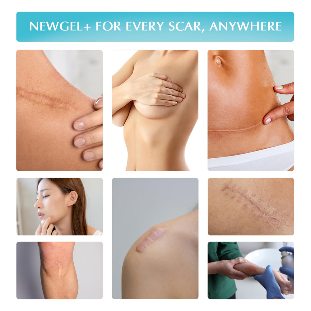 Fragrance-free MyNewGel Plus labeling suits sensitive skin.