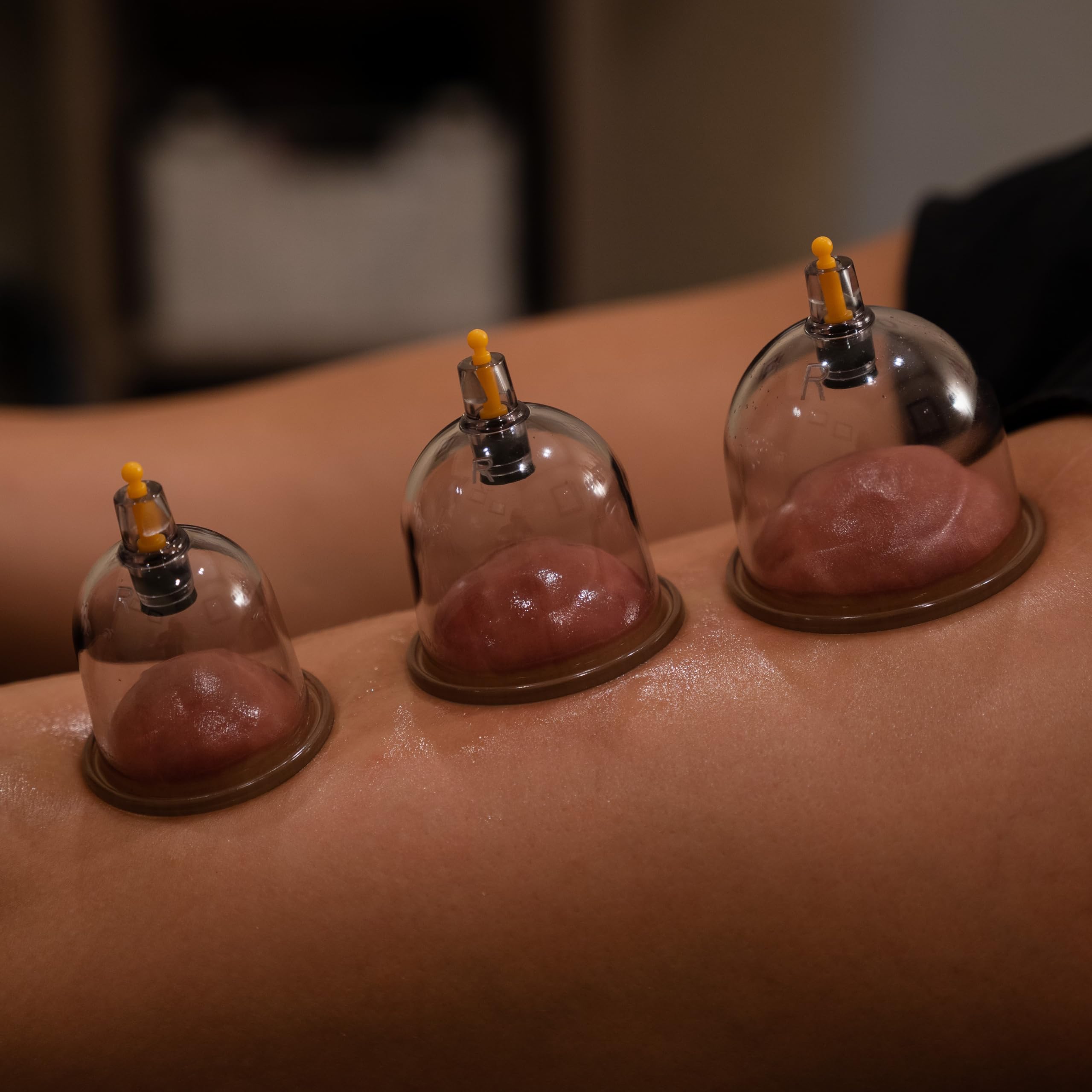 Myofascial Releaser professional use kit suitable for clinics and home setups.