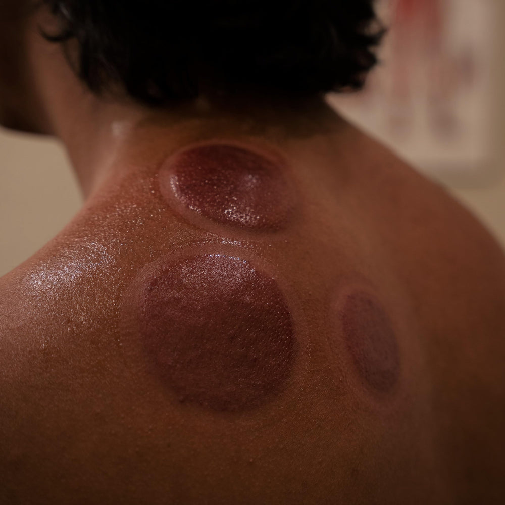 Myofascial Releaser therapy guide helps therapists plan sessions.