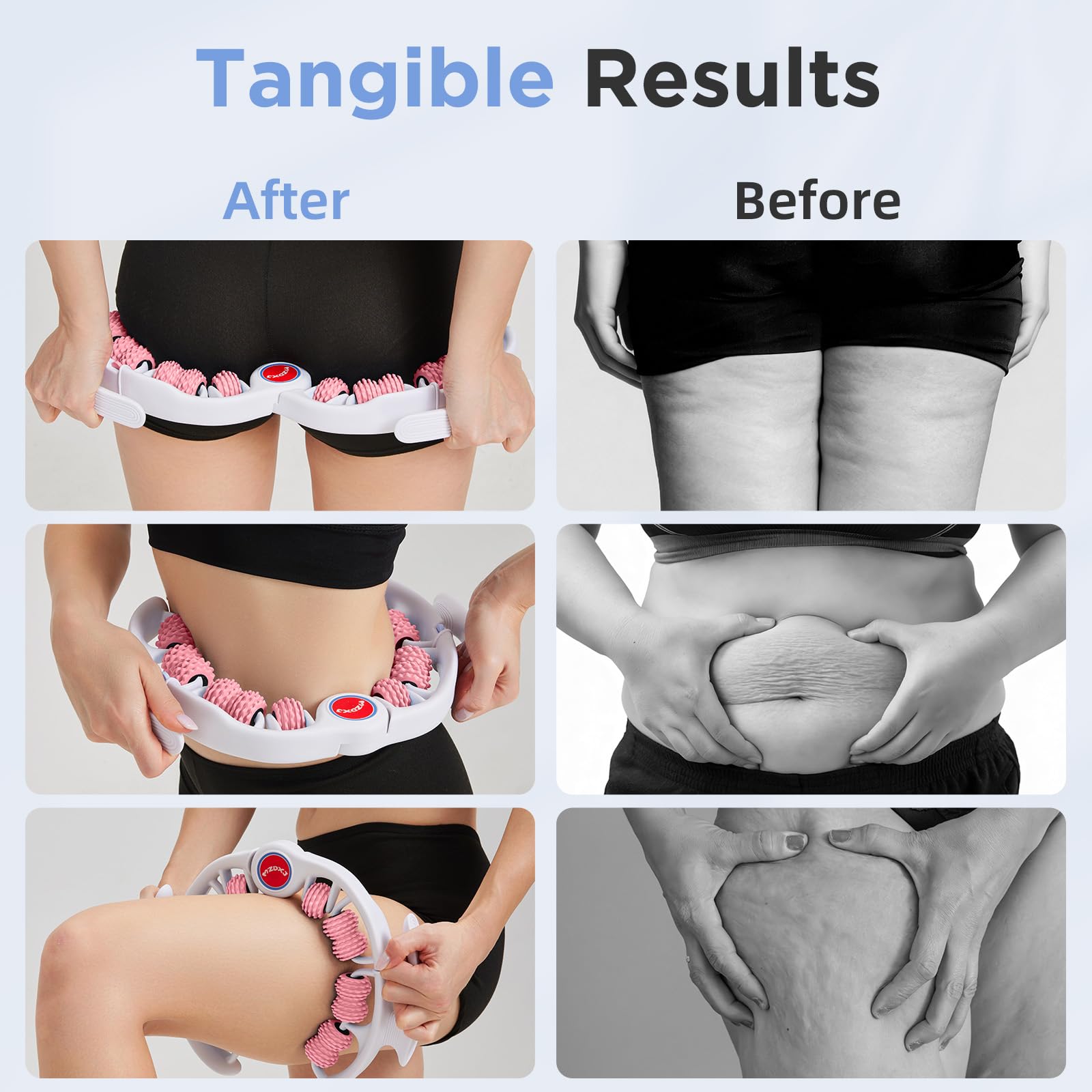 MZDXJ cellulite massage tool with oil glide for sensitive skin.