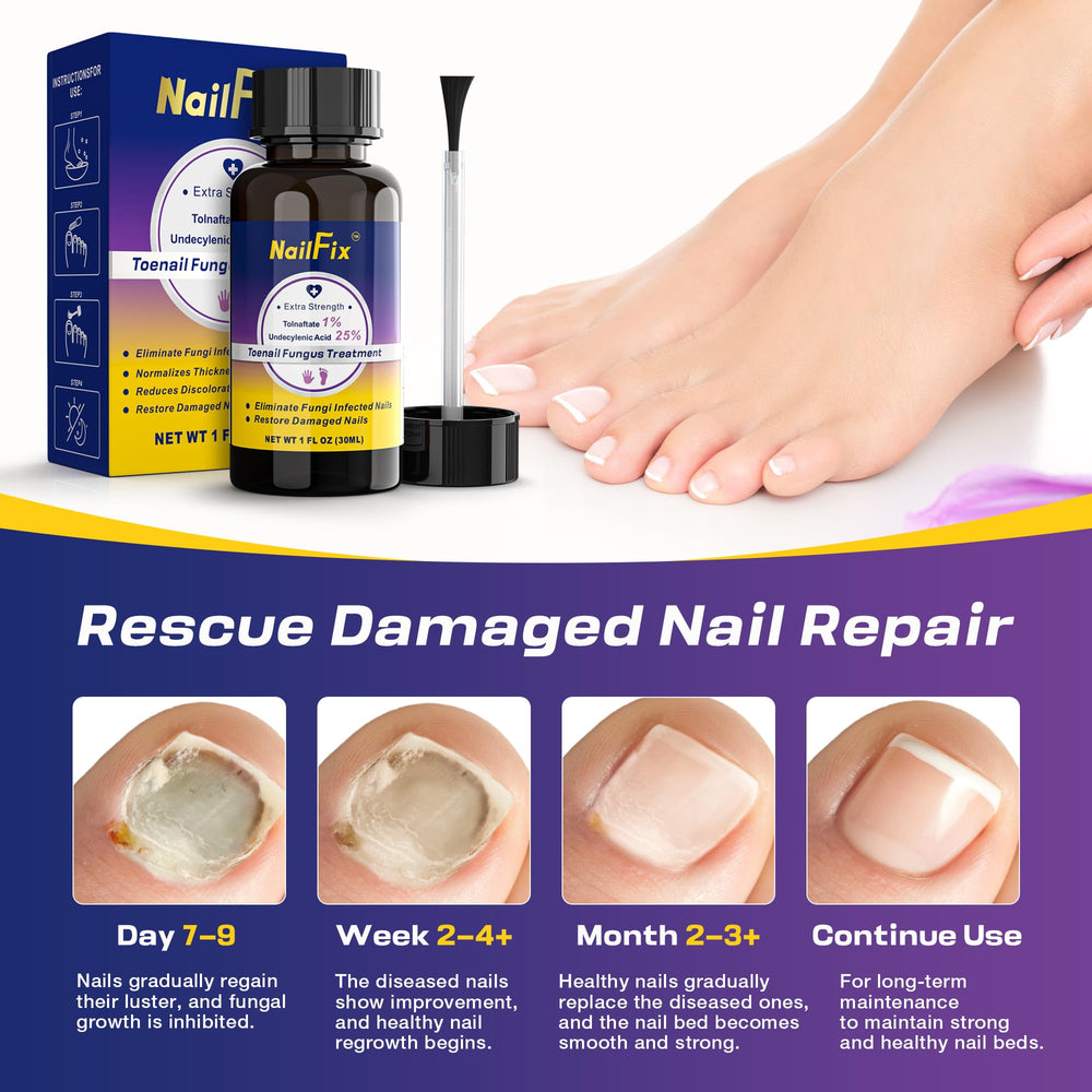 Wearing sandals with NailFix to feel more confident.