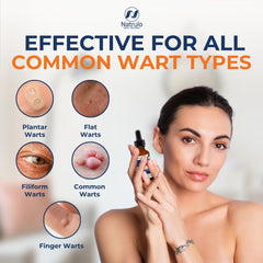 Natrulo Wart Remover drops on a cotton swab for targeted care.