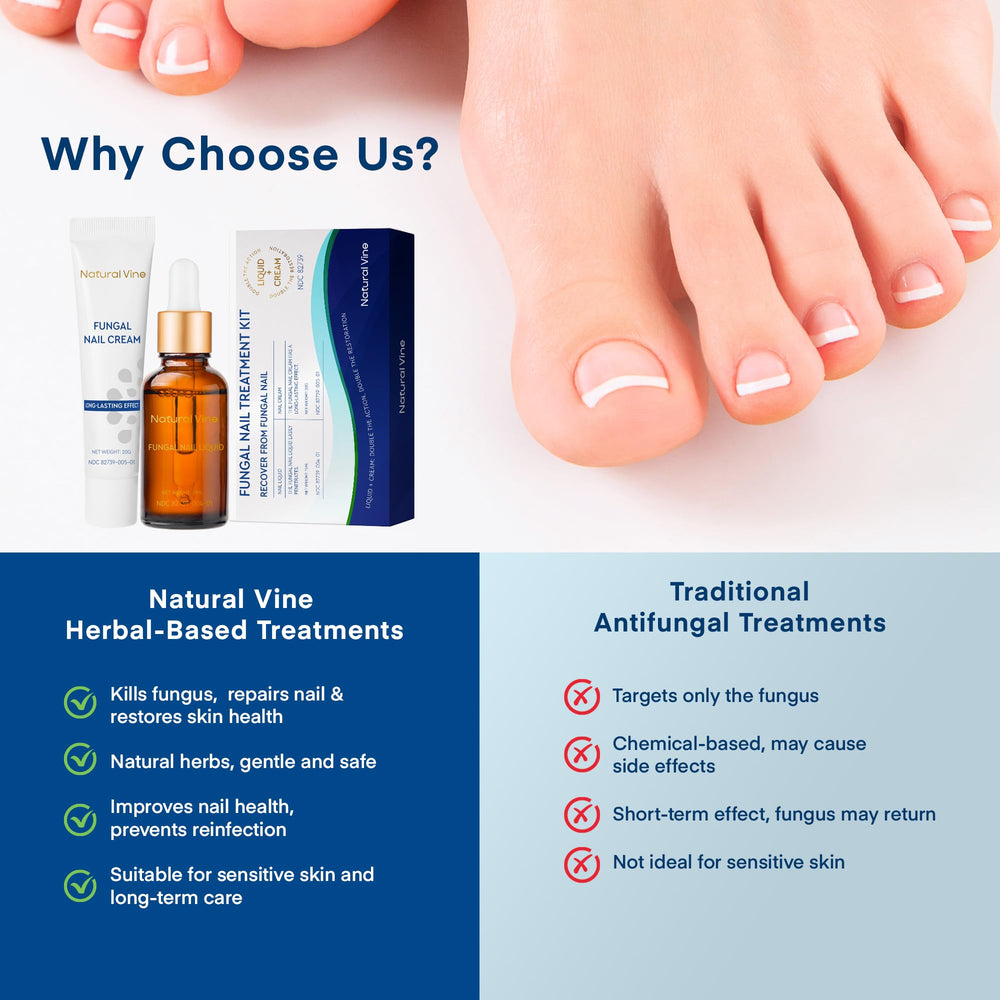 Natural Vine fungus treatment in-use on a nail.