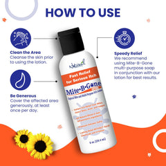 Naturasil Mite-B-Gone applied to hand for quick itch relief