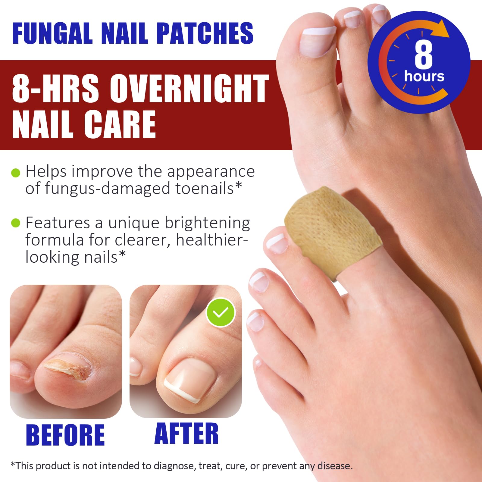NBTREKTIE toenail treatment with botanical formula for healthy-looking nails.