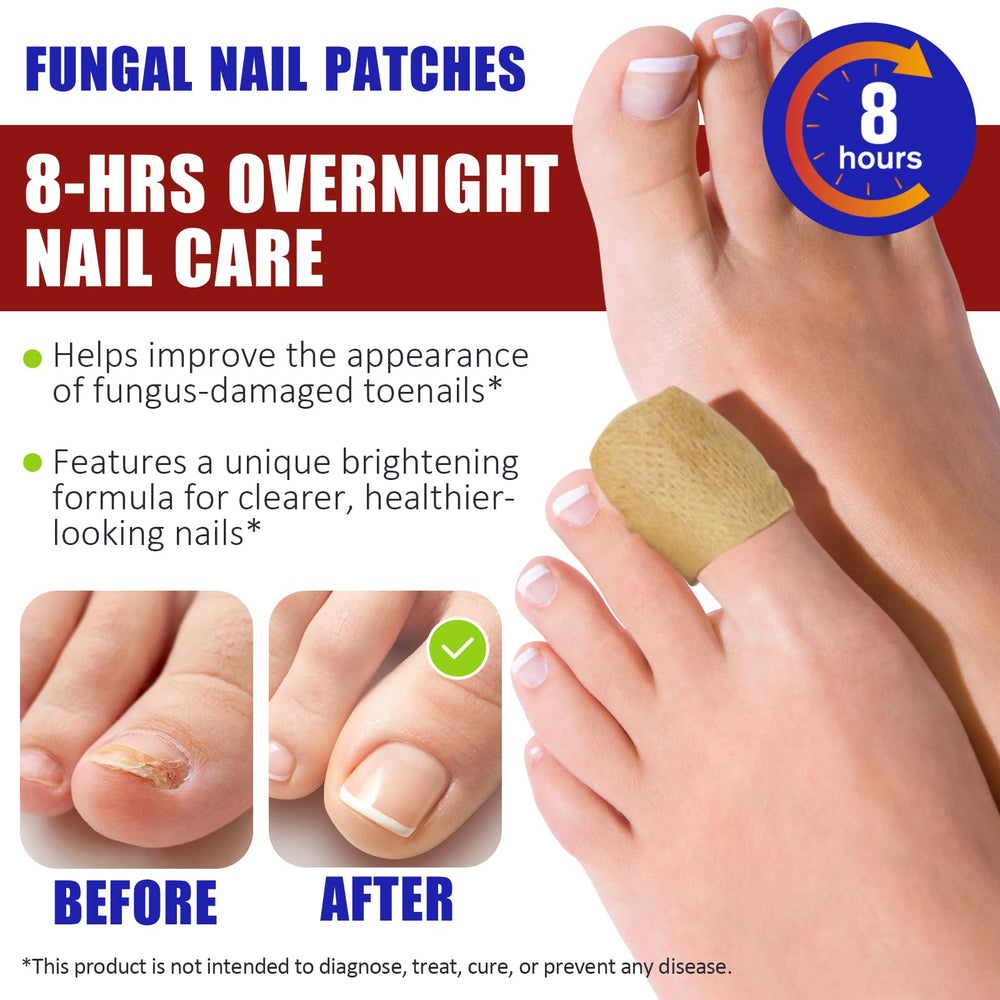 NBTREKTIE toenail treatment with botanical formula for healthy-looking nails.