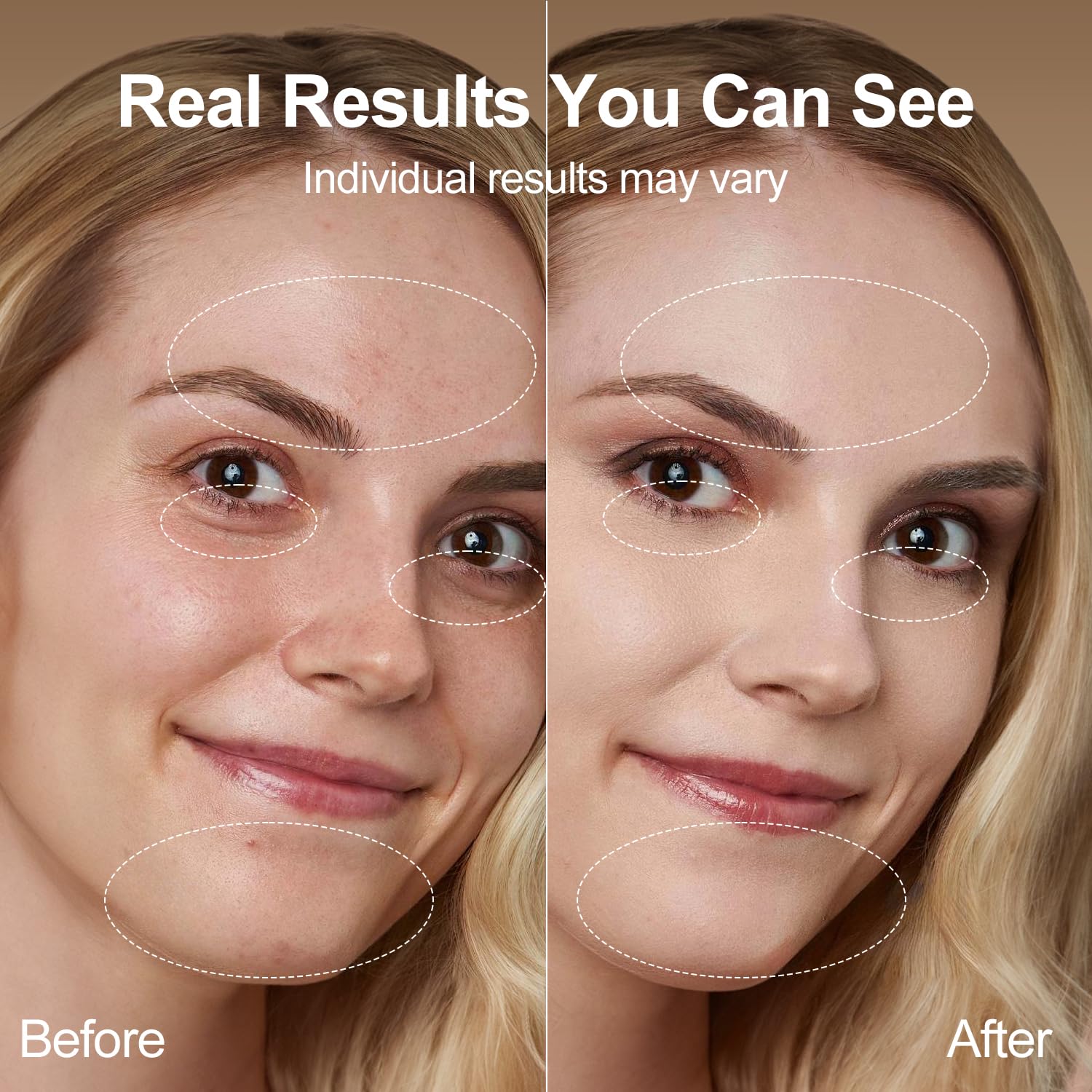 NeatLt blue light mode refreshes targeted facial areas