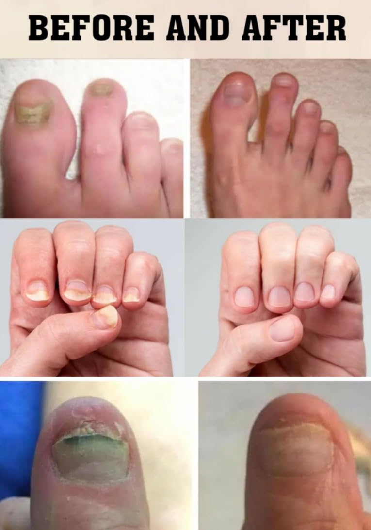 Neogentek daily nail conditioning in action for smoother nail surface