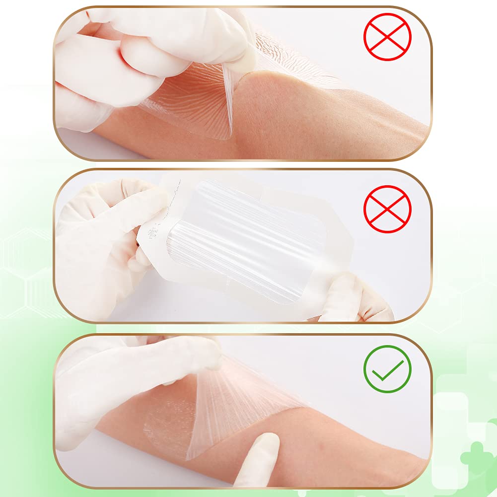 NEUHEILS dressing secures instruments and devices without shifting.