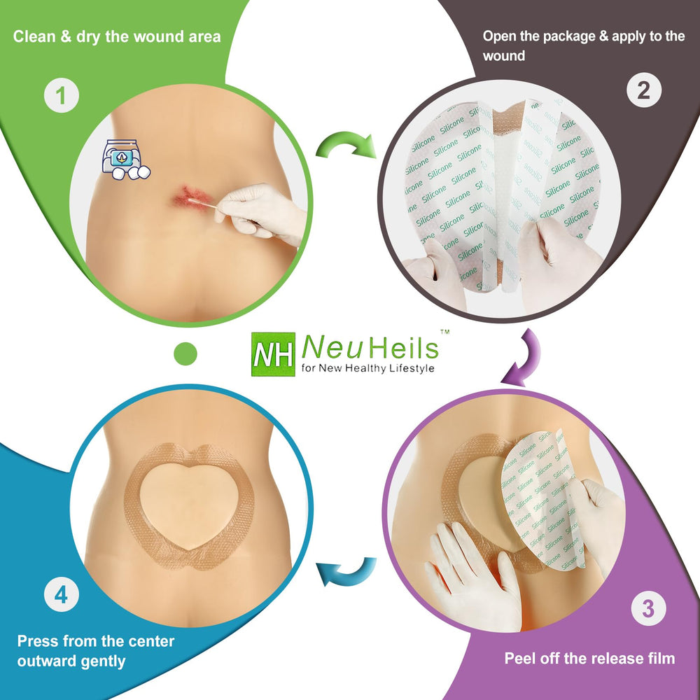 NeuHeils latex-free dressing suitable for sensitive skin
