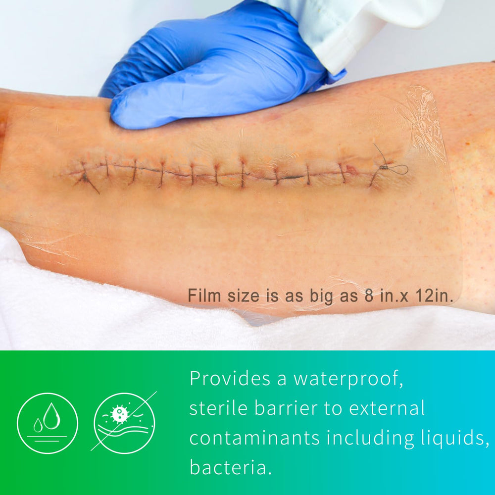 NeuHeils latex-free film dressing is safe for sensitive skin