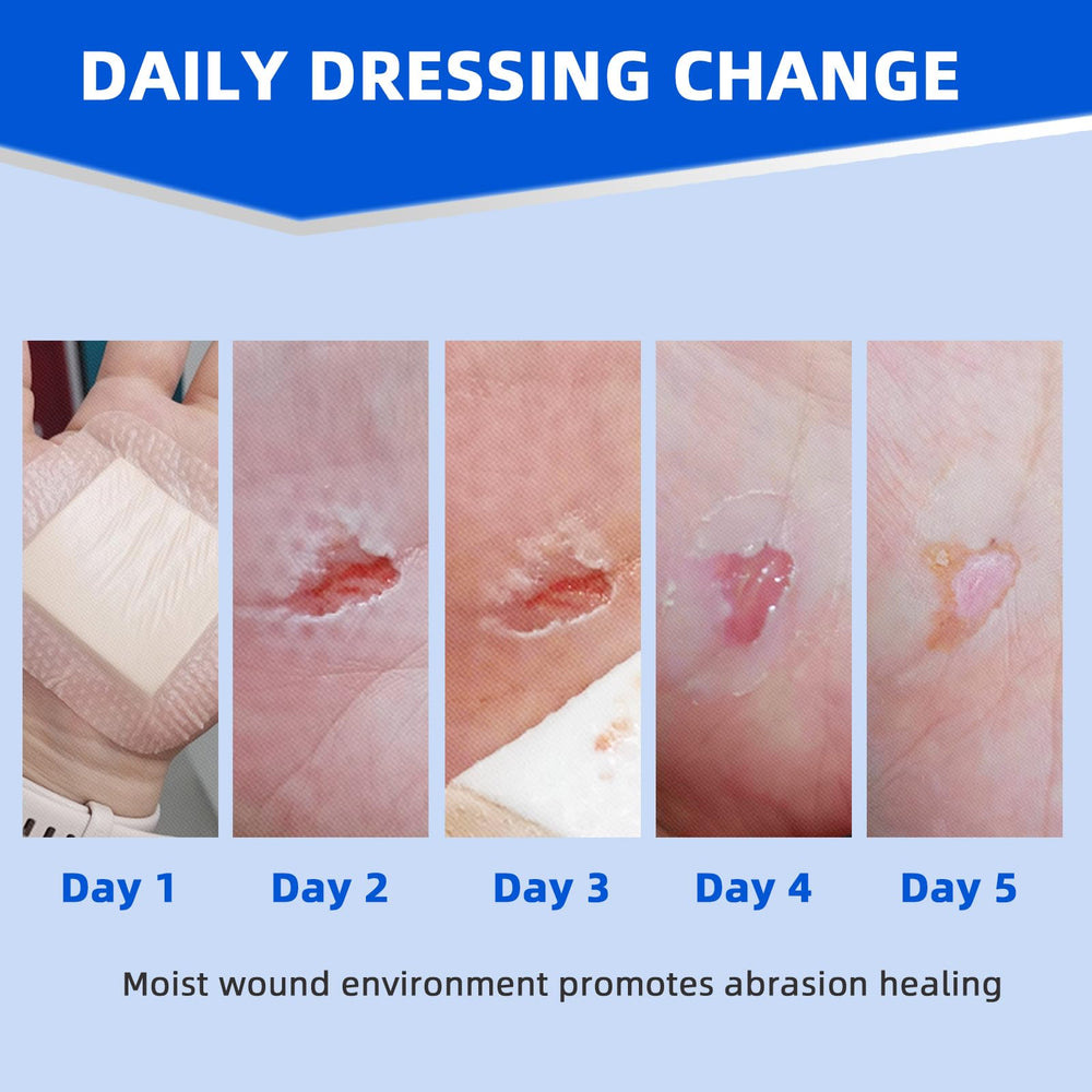 Niceful dressing with soft silicone contact layer is gentle on sensitive skin.