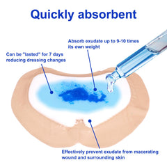 Niceful silicone contact layer reduces irritation and enables gentle removal