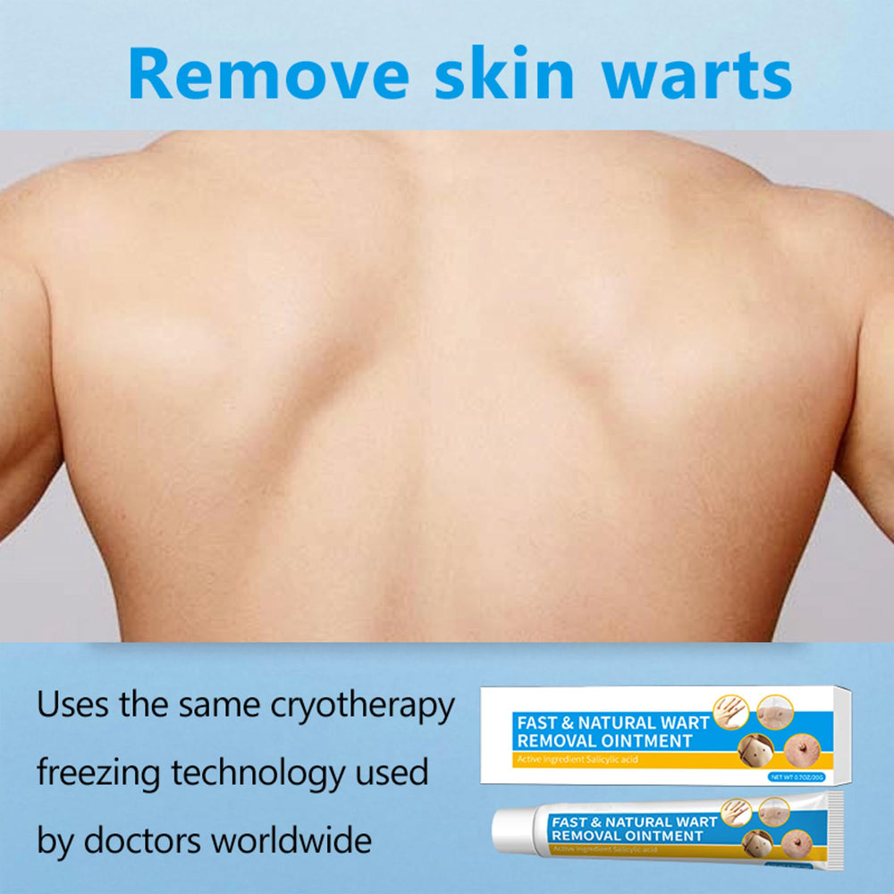 Nicetuff Wart Remover tips for daily at home use