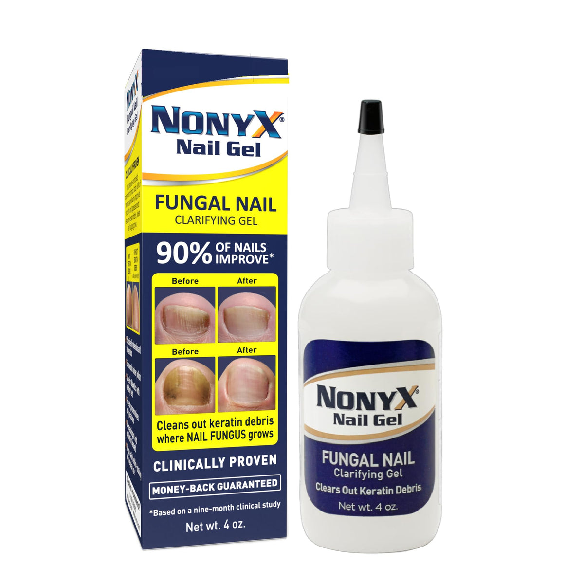 NONYX fungal nail clarifying gel bottle for easy daily application and visible improvements.