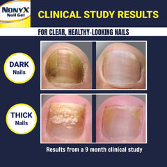NONYX fungal nail clarifying gel packaging box provides clear product information on shelf.