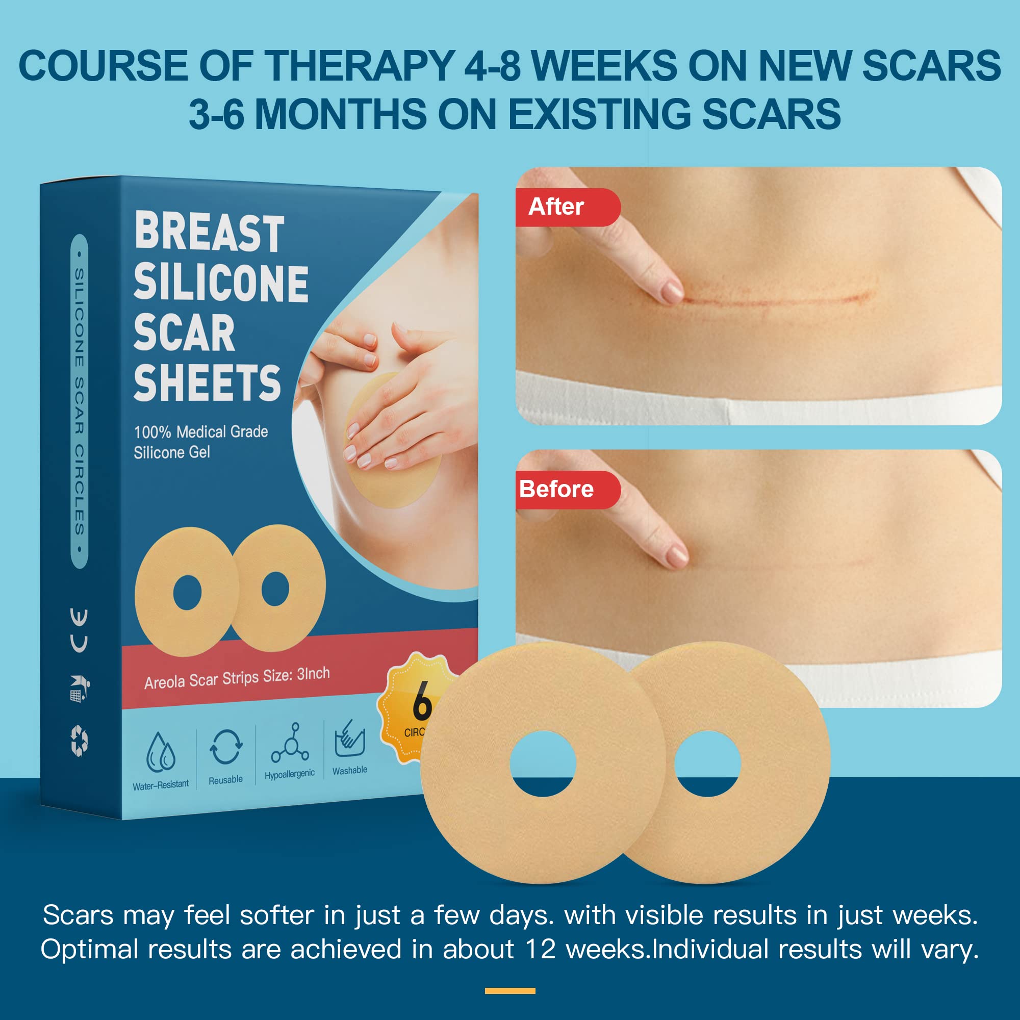 Nubical breast scar sheets adhere securely to the chest area.