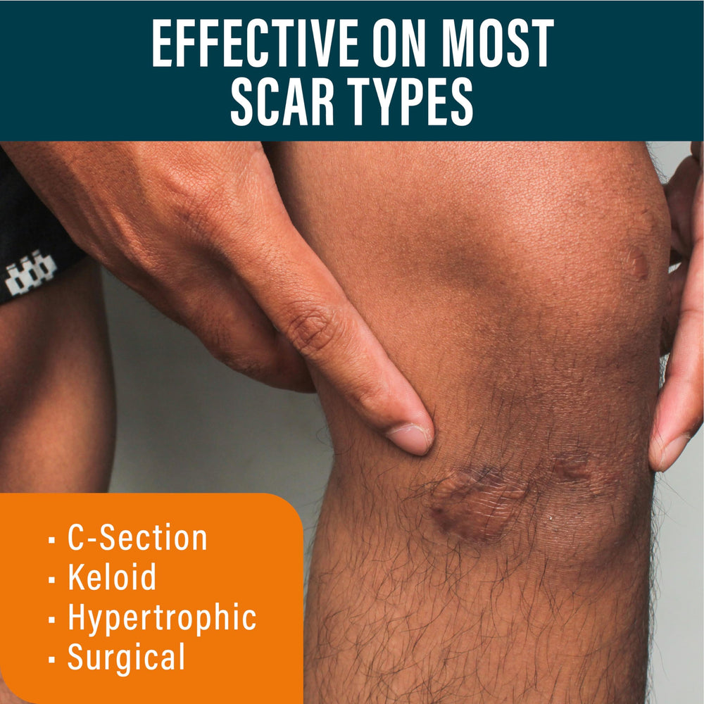 NUVADERMIS Advanced Scar Gel packaging displayed on a clean surface.