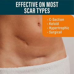 NUVADERMIS silicone scar sheets for tummy-tuck area offering comfortable wear.