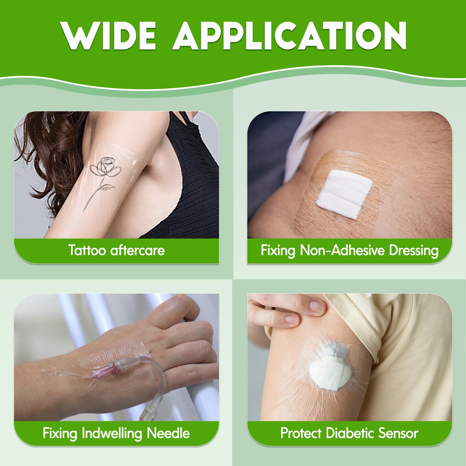 NXPPYY large waterproof dressing allows monitoring while protecting wounds