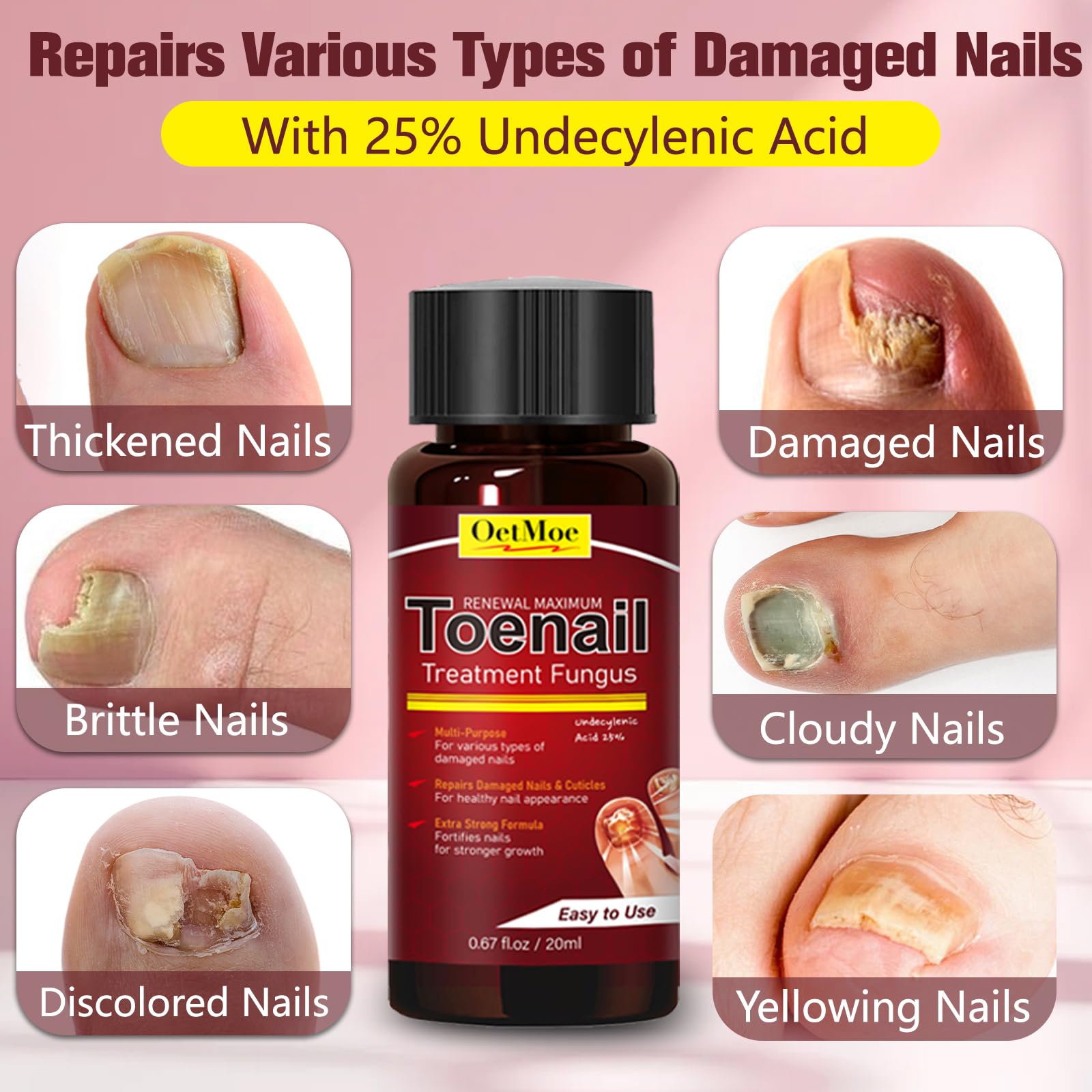 OETMOE damaged nails close-up highlights texture before and after.