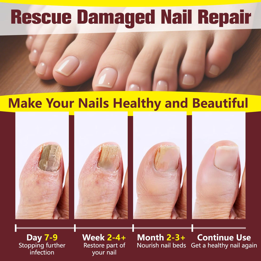 OETMOE nail repair liquid in action promotes healthier-looking nails.