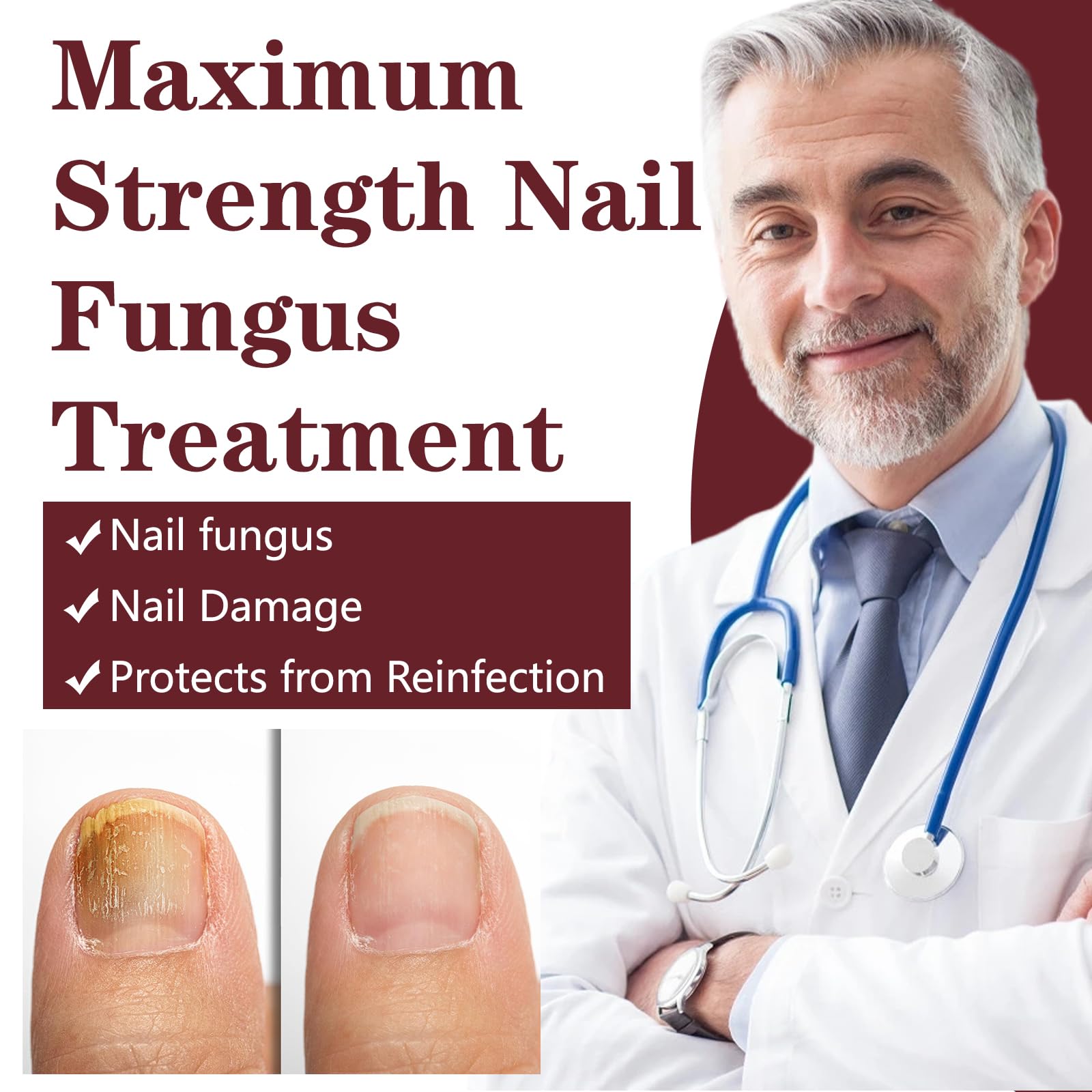 OETMOE thick nails image emphasizes relief with conditioning formula.